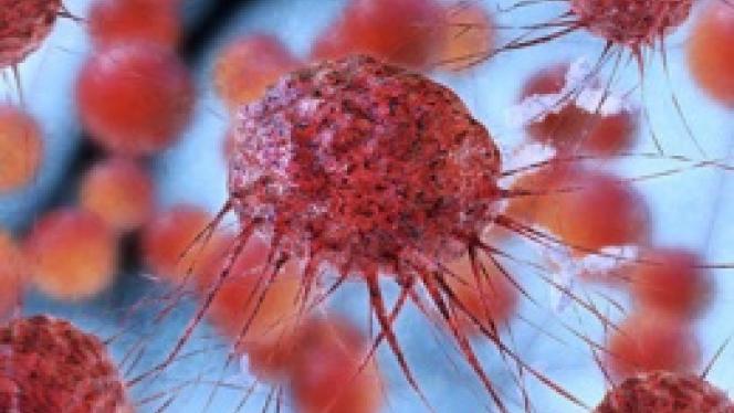 Illustration of cancer cells