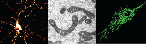 Picture displaying mitochondria in primary neutrons (left) and neuronal cell lines (middle and right).