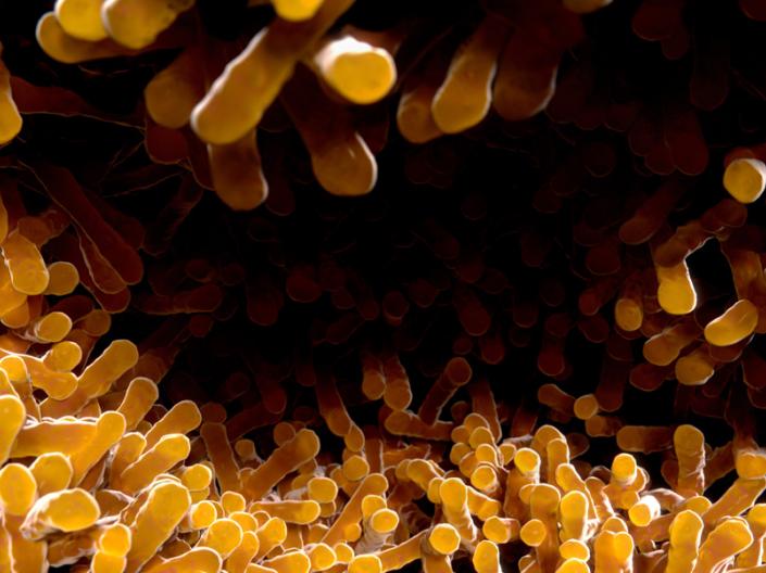 Close up image of tuberculosis cells