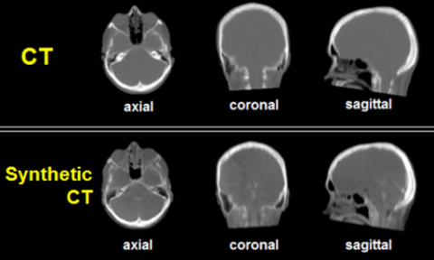 MRI images of a someones head. 