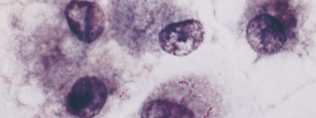 TB infected cells.