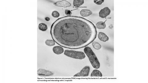 Transmission electron microscopy (TEM) showing the bacteria E. coli and S. marcescens surrounding the fungus Candida tropicalis.