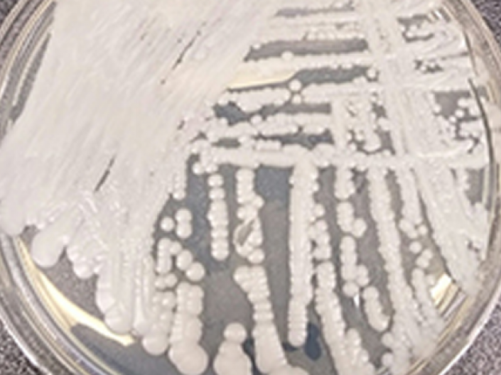 Clear petri dish with white sample of candida auris