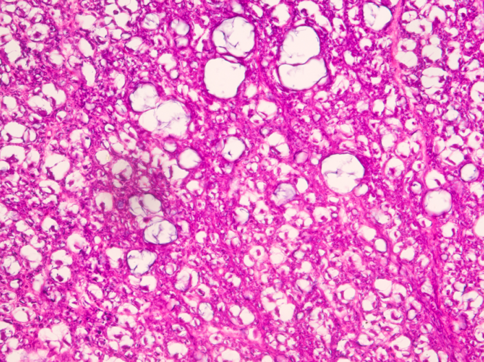 Spinal cord nerve cell section under microscope for education