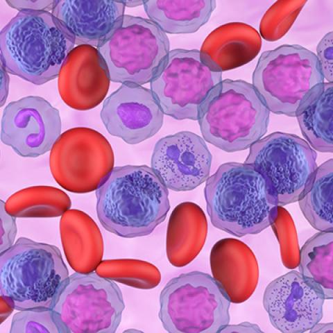 stock graphic image of leukemia cells