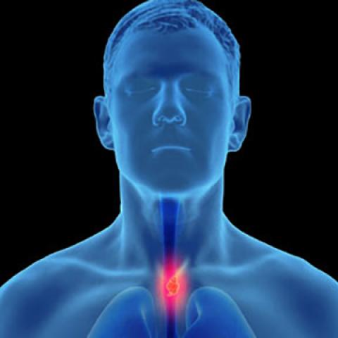 graphic image of body with esophagus highlighted