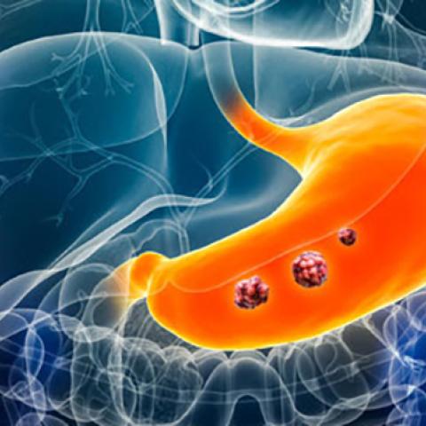 Graphic with stomach highlighted