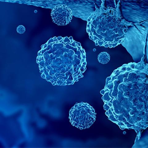 graphic image of cancer cells