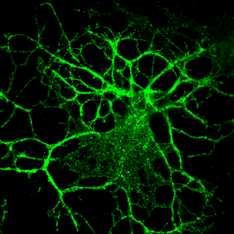 oligodendrocyte