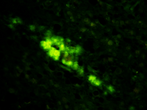 colored microspic image of Synthetic human prions 