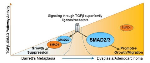 Graphical abstract of TGF-beta pathway activity during progression of esophageal adenocarcinoma