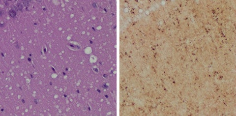 Microscopic examination of brain tissues of prion-infected animals
