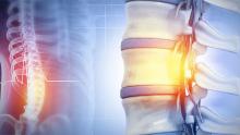Graphic image showing area of spinal cord injury
