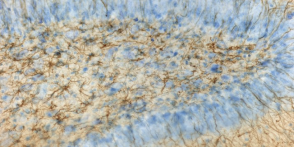 Histological image of brain tissue