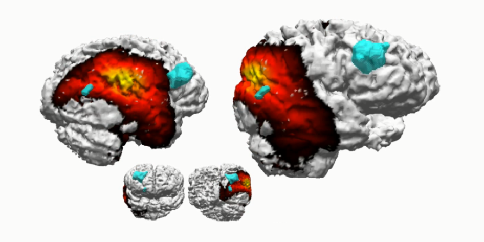 fMRI of brain while gambling