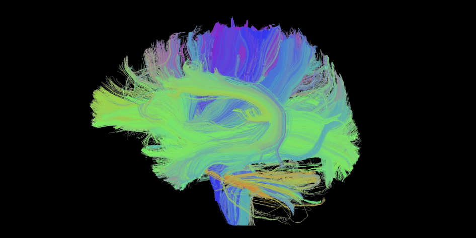 Tractography map of the brain
