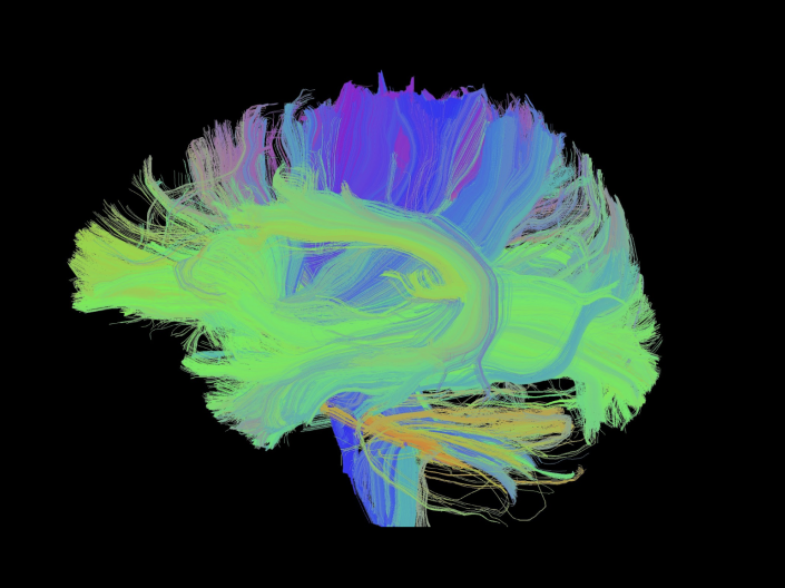 Tractography map of the brain