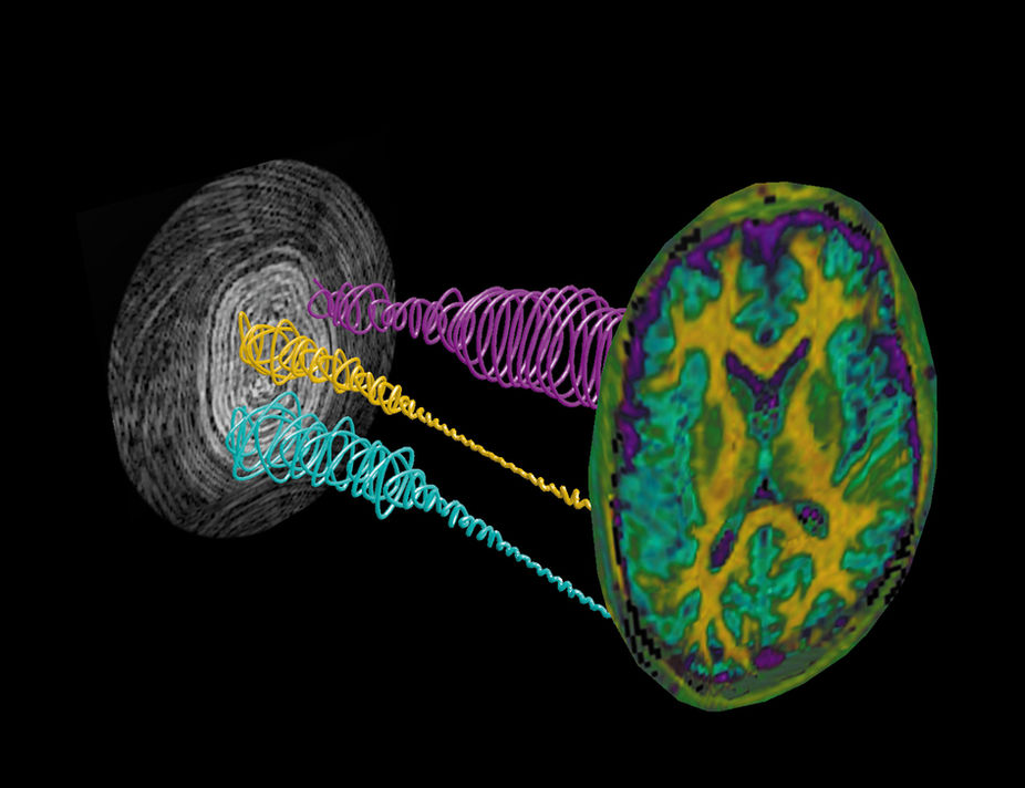 Drawing of the magnetic resonance fingerprinting technique