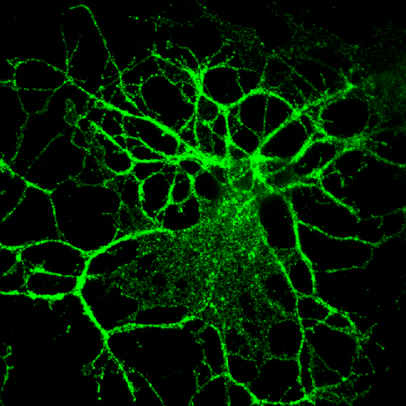 Myelin-producing brain cell with PLP protein stained in green