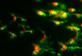 Blood_flourescent