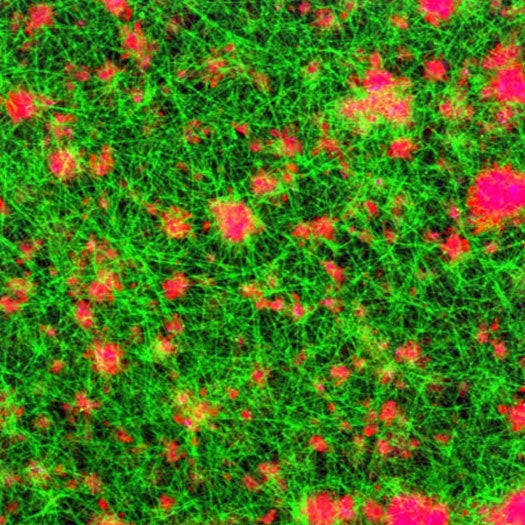 Fibrin_PPN_Clot