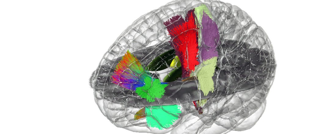A 3-D illustration of a human brain