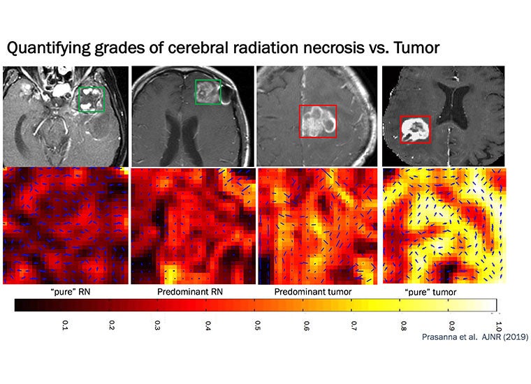 Actual images of brain tissue scans showing 'hot' areas where cancer is present