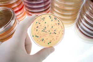 Bacteria in a Dish