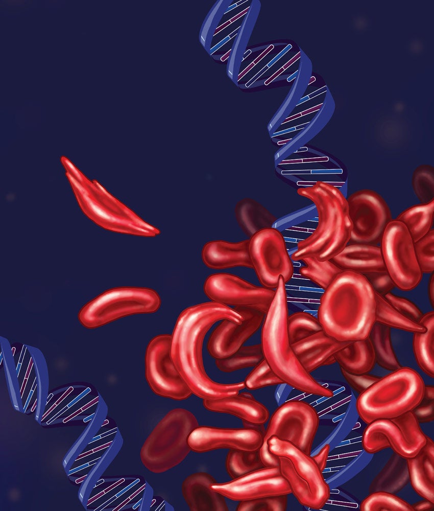 Illustration showing sickled blood cells and strands of DNA