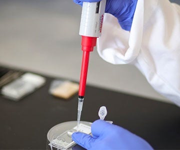 Biochip Blood 2