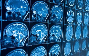 brains