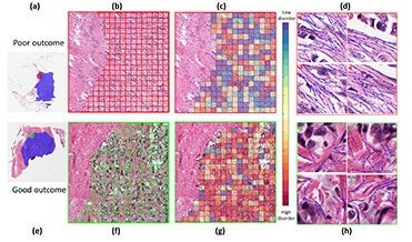 images of collagen networks in breast tissue
