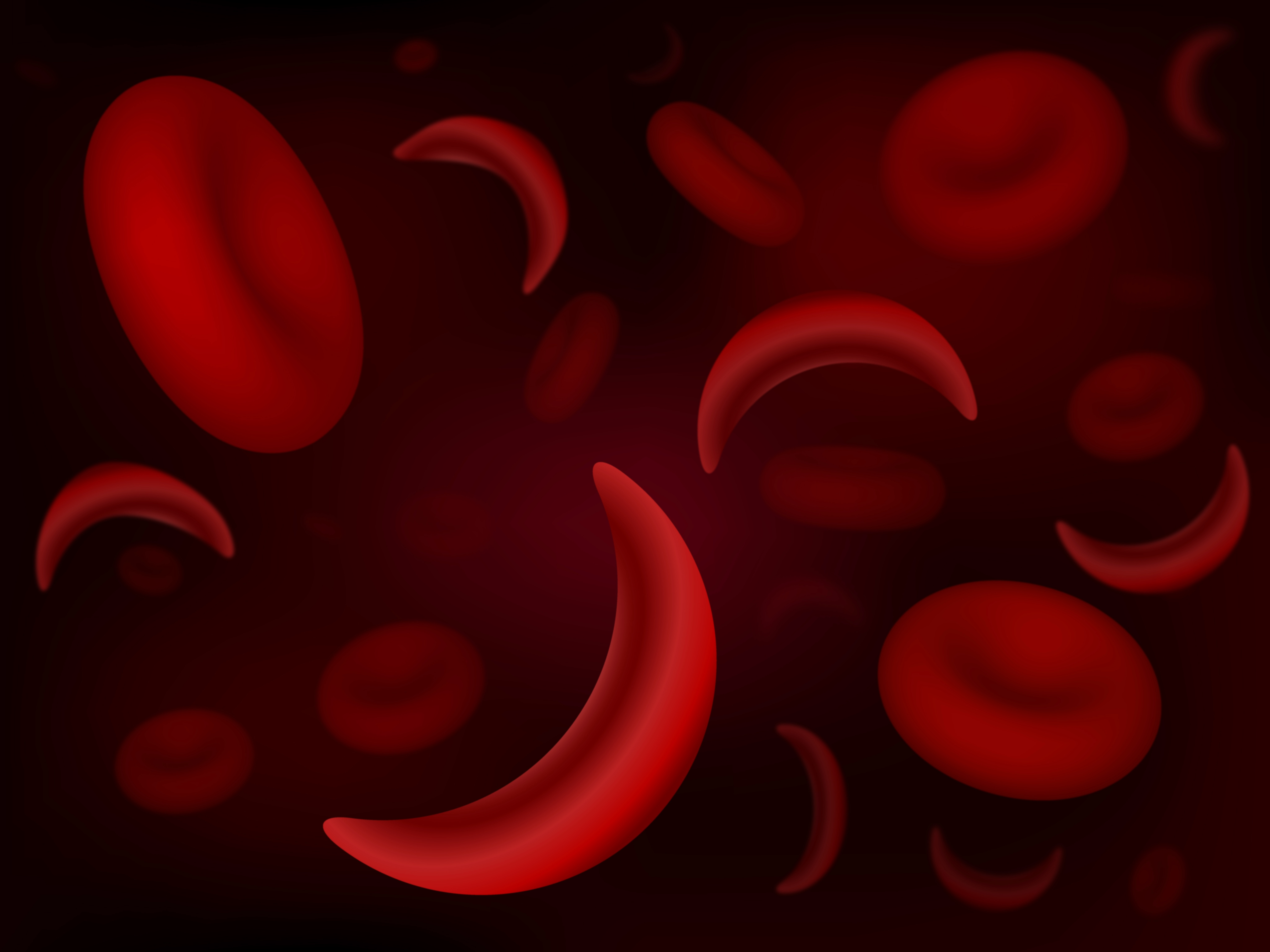 sickle cell blood cell