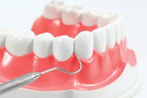 Dental Hp1 300x200