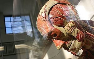Dittrick Museum of Medical History exhibit