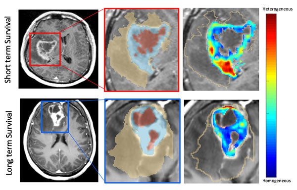 MRI images of a human brain
