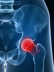 Hip Joint Diagram