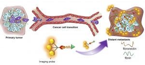 For earlier detection of metastases, Case Western Reserve University researchers developed a magnetic resonance imaging contrast agent that includes a probe that binds to fibrin-fibronectin complexes found in aggressive breast cancers. Fibronectin is expressed by high-risk primary and metastatic tumors, distinguishing them from normal tissue. (click to enlarge)