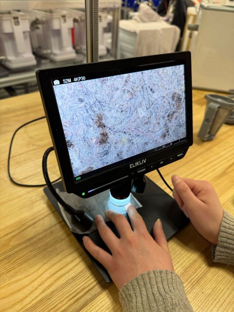Photo of someone showing the microscopic view of a used VORTX filter