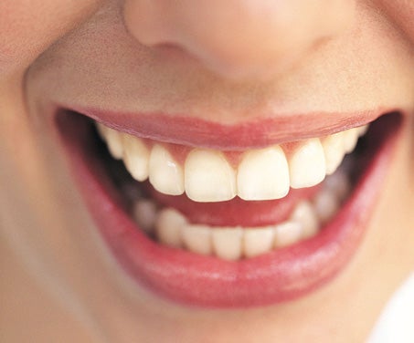 Photo of mouth examination.