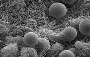 Spherical hemostatic nanoparticles accumulate on a clot-stabilizing mesh of fibrin the body produces. Credit: Andrew Shoffstall