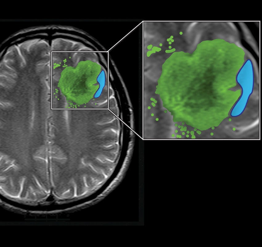 Illustration of brain scan technology