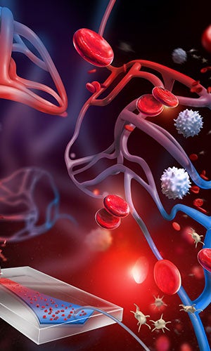 Illustration of a Sickle cell disease biochip blood-cell adhesion test 
