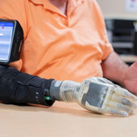 Photo showing a man using an advanced prosthesis