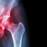 Engineering's Ozan Akkus discusses arthritis research to grow replacement  joints