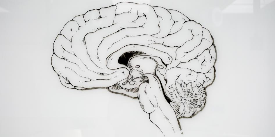 whiteboard with a detailed brain drawn on it