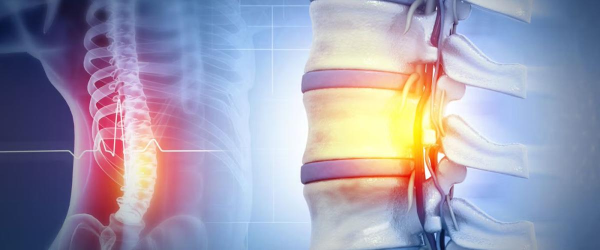 Spinal cord