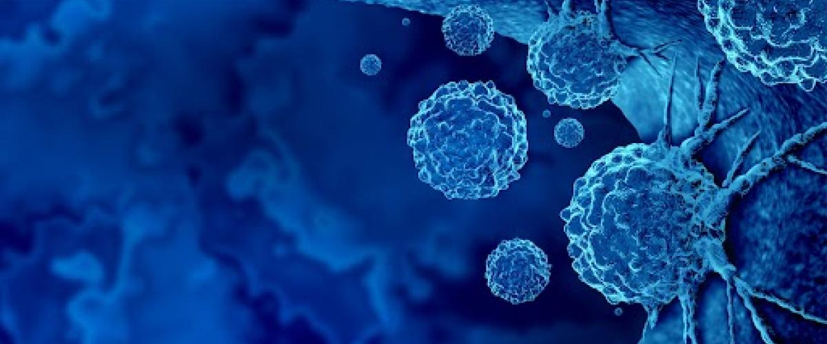 A vision for rare cancer research: $5 million commitment launches