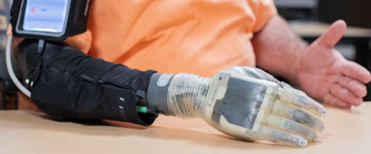 Photo showing a man using an advanced prosthesis