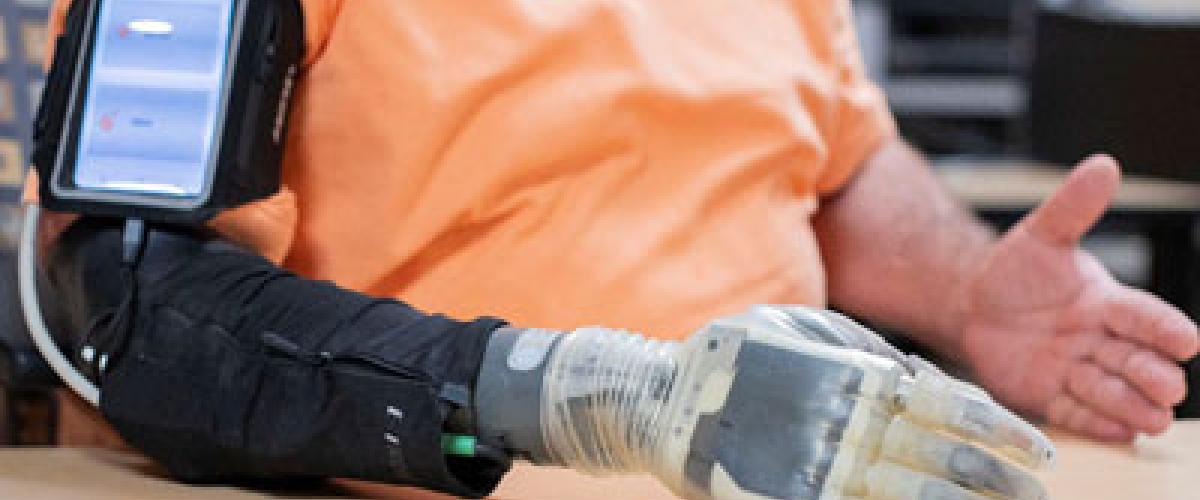 Photo showing a man using an advanced prosthesis